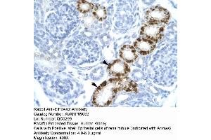Human kidney (EIF2AK2 Antikörper  (C-Term))