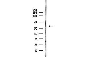 Western blot analysis of lysates from HepG2 cells(starvation,24h treatment), using MC Antibody at 1/1000 dilution.