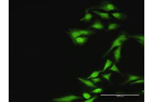 Immunofluorescence of purified MaxPab antibody to ASPSCR1 on HeLa cell.