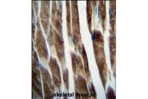 ILK Antibody (Center) 5884c immunohistochemistry analysis in formalin fixed and paraffin embedded human skeletal muscle followed by peroxidase conjugation of the secondary antibody and DAB staining. (ILKAP Antikörper  (AA 243-270))
