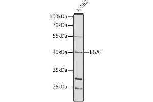 Western blot analysis of extracts of K-562 cells, using BGAT antibody (ABIN3022190, ABIN3022191, ABIN3022192 and ABIN6218658) at 1:1000 dilution. (ABO Antikörper  (AA 54-354))