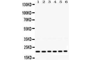 Western Blotting (WB) image for anti-RAB10, Member RAS Oncogene Family (RAB10) (AA 153-185), (C-Term) antibody (ABIN3043448) (RAB10 Antikörper  (C-Term))