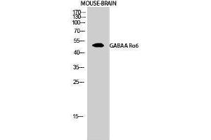 Western Blotting (WB) image for anti-gamma-aminobutyric Acid (GABA) A Receptor, alpha 6 (GABRA6) (Internal Region) antibody (ABIN3175195) (GABRA6 Antikörper  (Internal Region))