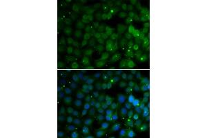 Immunofluorescence analysis of U2OS cells using HPD antibody.