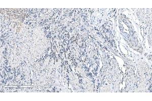 IHC analysis of METTL3 using anti-METTL3 antibody (ABIN7602808).