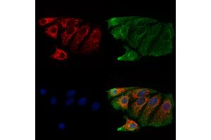 ABIN6261004 and ABIN6273214 staining Hela cells by IF/ICC. (CPLX2 Antikörper  (Internal Region))