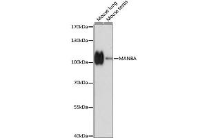Western blot analysis of extracts of various cell lines, using MANBA antibody.