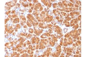 Formalin-fixed, paraffin-embedded human Pancreas stained with Clathrin, LC Monoclonal Antibody (CLC/1421). (CLTA/CLTB Antikörper  (N-Term))