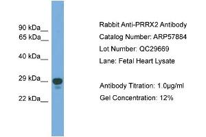 WB Suggested Anti-PRRX2  Antibody Titration: 0.