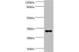 Western blot All lanes: STX11 antibody at 6 μg/mL + Mouse skeletal muscle tissue Secondary Goat polyclonal to rabbit IgG at 1/10000 dilution Predicted band size: 33 kDa Observed band size: 33 kDa (Syntaxin 11 Antikörper  (AA 1-287))