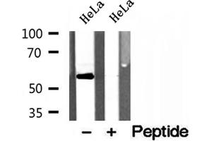Western blot analysis of extracts of HeLa cells, using PDLIM7 antibody. (PDLIM7 Antikörper  (N-Term))