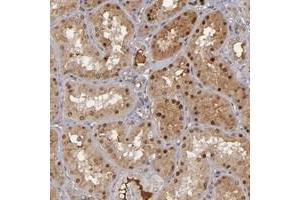 Immunohistochemical staining of human kidney with ZNF234 polyclonal antibody  shows distinct nuclear and moderate cytoplasmic positivity in cells in tubules at 1:50-1:200 dilution. (ZNF234 Antikörper)