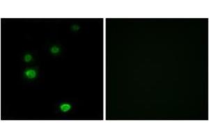 Immunofluorescence analysis of LOVO cells, using RPC5 Antibody.