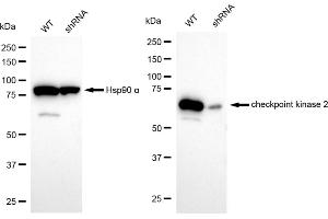 Western blotting analysis using checkpoint kinase 2 antibody (ABIN7798040). (Rekombinanter CHEK2 Antikörper)