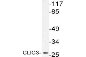 Western blot (WB) analysis of CLIC3 antibody in extracts from MCF-7 cells.