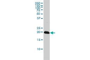 C22orf18 monoclonal antibody (M01), clone 4C12-2C8 Western Blot analysis of C22orf18 expression in K-562 .