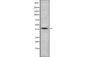 Western blot analysis of WNT11 using NIH-3T3 whole cell lysates (WNT11 Antikörper  (C-Term))