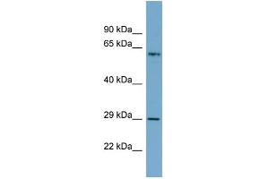 WB Suggested Anti-BATF2 Antibody Titration:  0. (BATF2 Antikörper  (N-Term))
