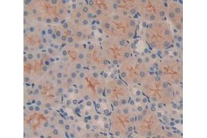 Used in DAB staining on fromalin fixed paraffin- embedded kidney tissue (ABCB7 Antikörper  (AA 472-752))