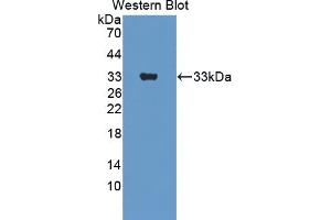 Detection of Recombinant ErbB3, Mouse using Polyclonal Antibody to V-Erb B2 Erythroblastic Leukemia Viral Oncogene Homolog 3 (ErbB3) (ERBB3 Antikörper  (AA 707-964))