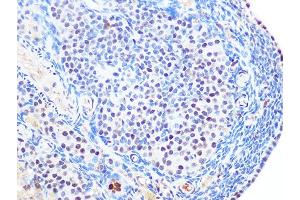 Immunohistochemistry of paraffin-embedded rat ovary using SUMO2/3 Rabbit mAb (ABIN7270370) at dilution of 1:100 (40x lens). (SUMO2 Antikörper)