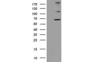 Western Blotting (WB) image for anti-Zinc Finger, Imprinted 2 (ZIM2) (AA 1-150), (AA 428-527) antibody (ABIN1490588) (ZIM2 Antikörper  (AA 1-150, AA 428-527))