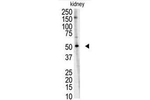 Image no. 1 for anti-Ring Finger Protein 216 (RNF216) (C-Term) antibody (ABIN357474) (RNF216 Antikörper  (C-Term))