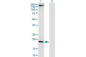 Western Blot analysis of FTL expression in transfected 293T cell line by FTL monoclonal antibody, clone 4C10. (FTL Antikörper)