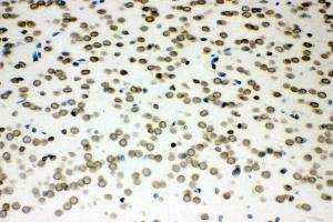 IHC analysis of Sumo 1/SUMO1 using anti-Sumo 1/SUMO1 antibody (ABIN7603002). (SUMO1 Antikörper  (Middle Region))