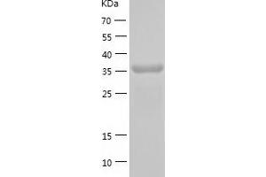 Western Blotting (WB) image for Dihydroorotate Dehydrogenase (DHODH) (AA 31-395) protein (His tag) (ABIN7122667) (DHODH Protein (AA 31-395) (His tag))