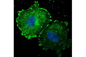 Fluorescent confocal image of MCF7 cells stained with phospho-ERBB2- antibody. (ErbB2/Her2 Antikörper  (pTyr1005))