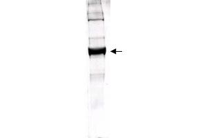 Figure 1. (GLUD1 Antikörper)