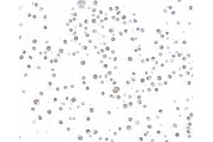 Immunocytochemistry (ICC) image for anti-Bloom Syndrome RecQ Like Helicase (BLM) (C-Term) antibody (ABIN7795726)