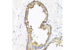 Immunohistochemistry of paraffin-embedded human prostate using SMAD2 antibody (ABIN5998884) at dilution of 1/100 (40x lens). (SMAD2 Antikörper)