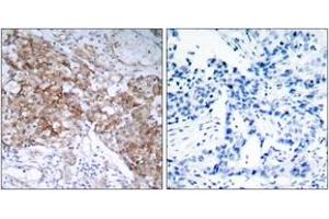 Immunohistochemistry (IHC) image for anti-Insulin-Like Growth Factor 1 Receptor (IGF1R) (AA 1126-1175) antibody (ABIN1532901)