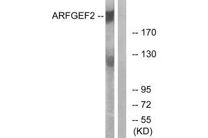 Western blot analysis of extracts from A549 cells, using ARFGEF2 antibody. (ARFGEF2 Antikörper  (C-Term))