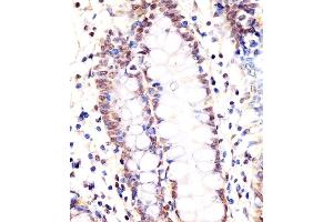 (ABIN6243725 and ABIN6578368) staining LSM2 in human colon tissue sections by Immunohistochemistry (IHC-P - paraformaldehyde-fixed, paraffin-embedded sections). (LSM2 Antikörper  (AA 55-89))