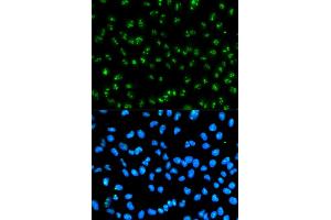 Immunofluorescence analysis of HeLa cells using FBL antibody. (Fibrillarin Antikörper)