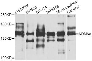 Western blot analysis of extracts of various cell lines, using KDM6A antibody (ABIN5974652) at 1/1000 dilution. (KDM6A Antikörper)