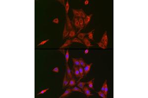Immunofluorescence (IF) image for anti-Nuclear Factor of kappa Light Polypeptide Gene Enhancer in B-Cells 1 (NFKB1) (AA 300-433) antibody (ABIN7268980)