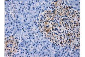 Immunohistochemical staining of paraffin-embedded liver tissue using anti-RPA2 mouse monoclonal antibody. (RPA2 Antikörper)