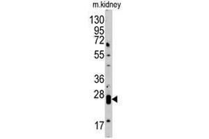 Western blot analysis of CLDN1 polyclonal antibody  in mouse kidney tissue lysate (35 ug/lane). (Claudin 1 Antikörper)
