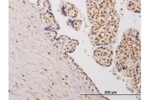 Immunoperoxidase of monoclonal antibody to TESK2 on formalin-fixed paraffin-embedded human placenta. (TESK2 Antikörper  (AA 405-542))