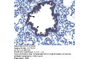 Human Lung (CHST4 Antikörper  (Middle Region))
