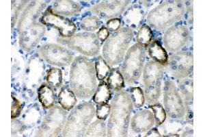 CASR was detected in paraffin-embedded sections of rat kidney tissues using rabbit anti- CASR Antigen Affinity purified polyclonal antibody (Catalog # ) at 1 µg/mL. (CASR Antikörper  (AA 926-1078))