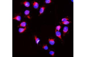 IF analysis of Peroxiredoxin 1 using anti- Peroxiredoxin 1 antibody (ABIN3043903).