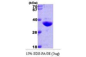 SDS-PAGE (SDS) image for NAD(P)H Dehydrogenase, Quinone 1 (NQO1) (AA 1-274) protein (His tag) (ABIN668043)