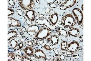 Immunohistochemical staining of paraffin-embedded Kidney tissue using anti-MTRF1L mouse monoclonal antibody.