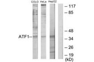 Western blot analysis of extracts from HepG2/COLO205/HeLa cells, using ATF1 Antibody. (AFT1 Antikörper  (AA 176-225))