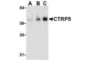 Western blot analysis of CTRP5 in human brain cell lysate with AP30254PU-N CTRP5 antibody at (A) 1, (B) 2, and (C) 4 μg/ml.